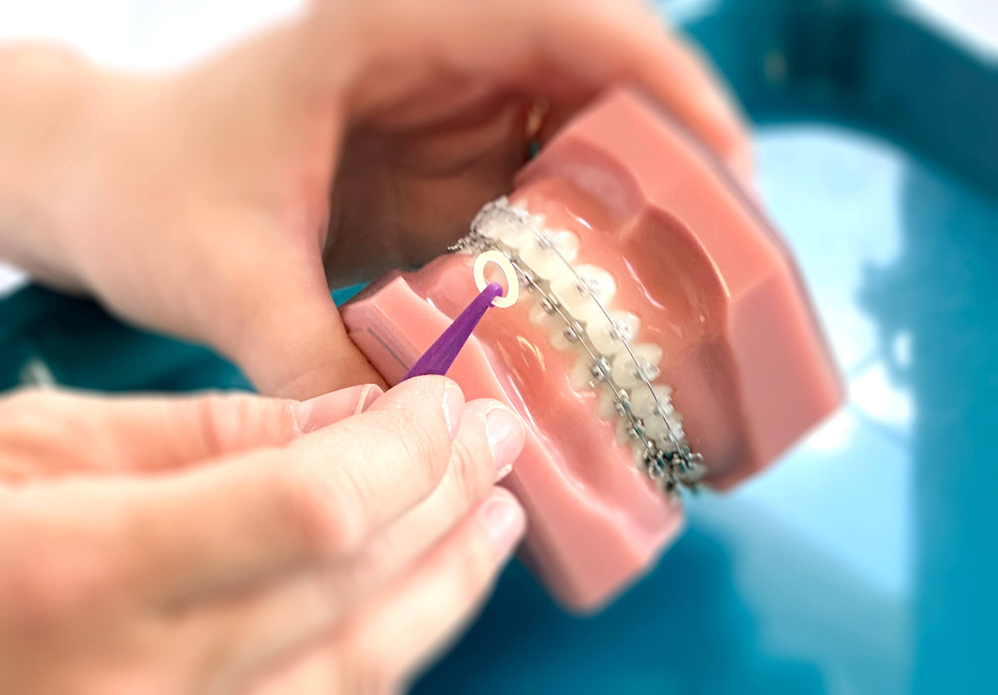 Bild zeigt das Anbringen eines Gummizugs an einer Zahnspange